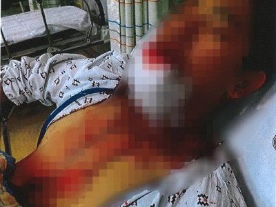 새벽 식당서 혼밥하던 30대 장애인…무차별 폭행한 두 고교생(사진 주의)